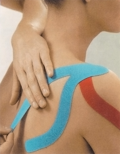 Kinesio-Tape in der Physiotherapie